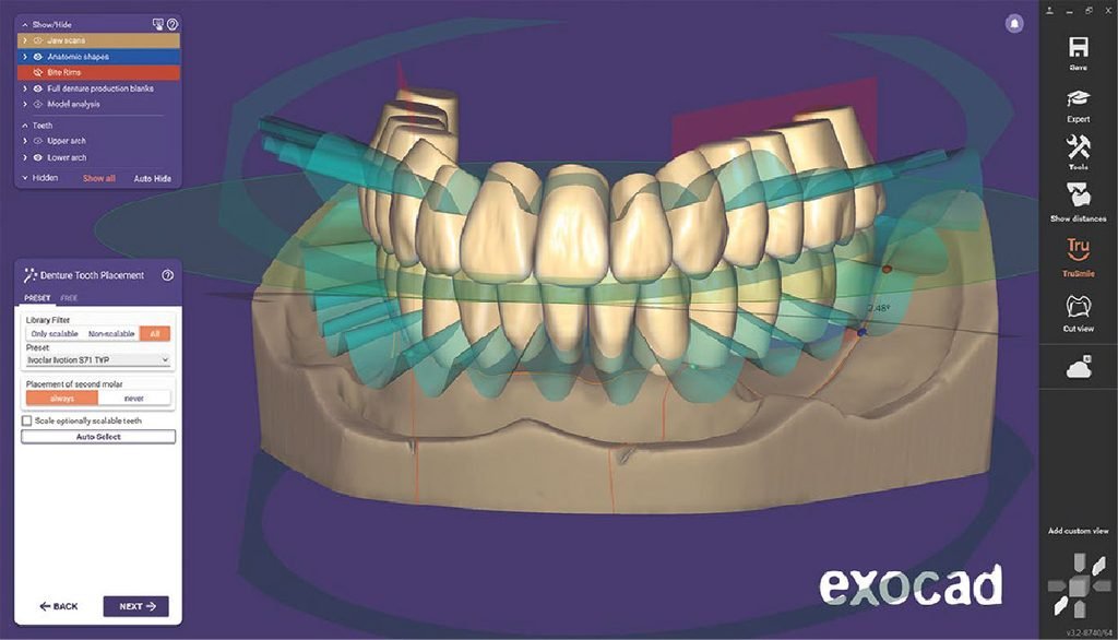 دورات Exocad